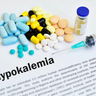 Diagnosis and treatment of Hypocalcemia