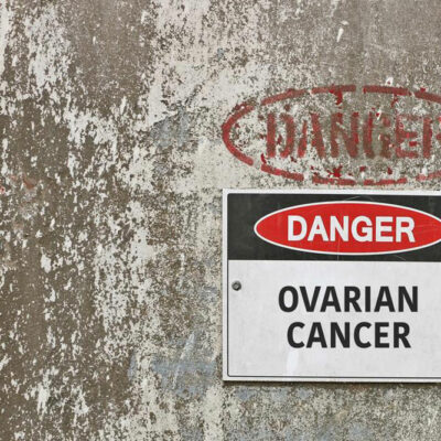 Treatment options for ovarian cancer