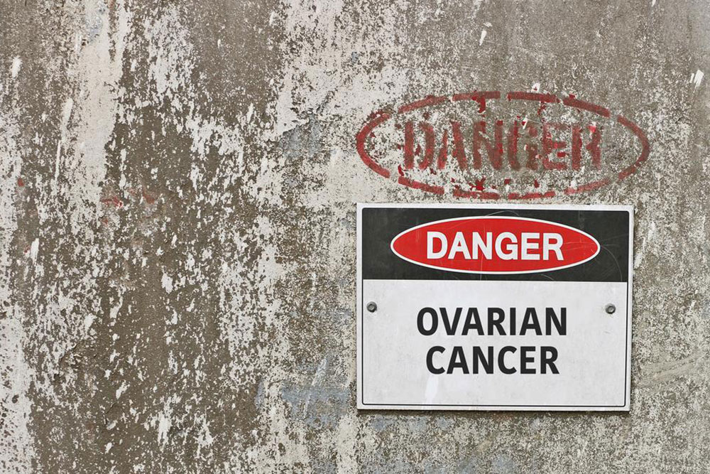 Treatment options for ovarian cancer