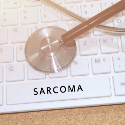 Kaposi’s sarcoma and its types